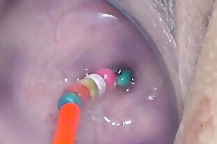 Insertion